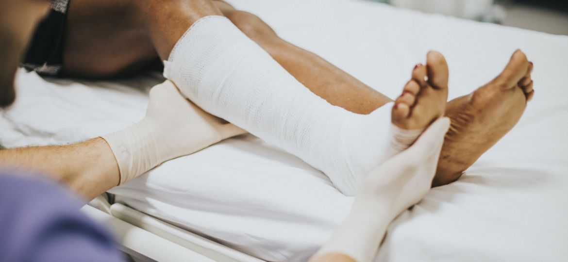 Doctor helping a patient with a fractured leg